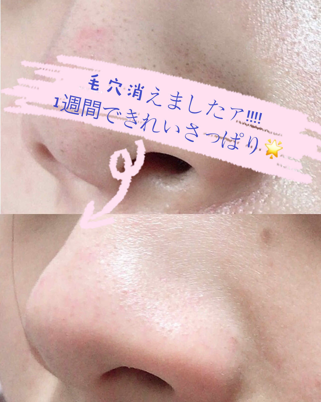 「朝洗顔をするべきか「肌質・肌悩み」によって見極めよう!あなたに合った朝洗顔のやり方を解説」の画像(#192413)