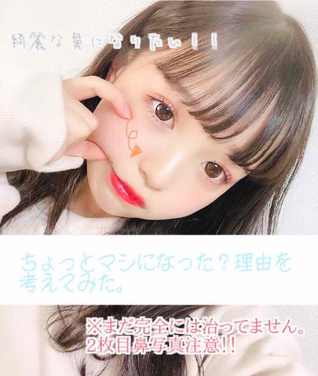 「《脂性肌を攻略!》スキンケアの順番や選び方を解説【デパコス・プチプラ】おすすめアイテム22選」の画像(#196694)