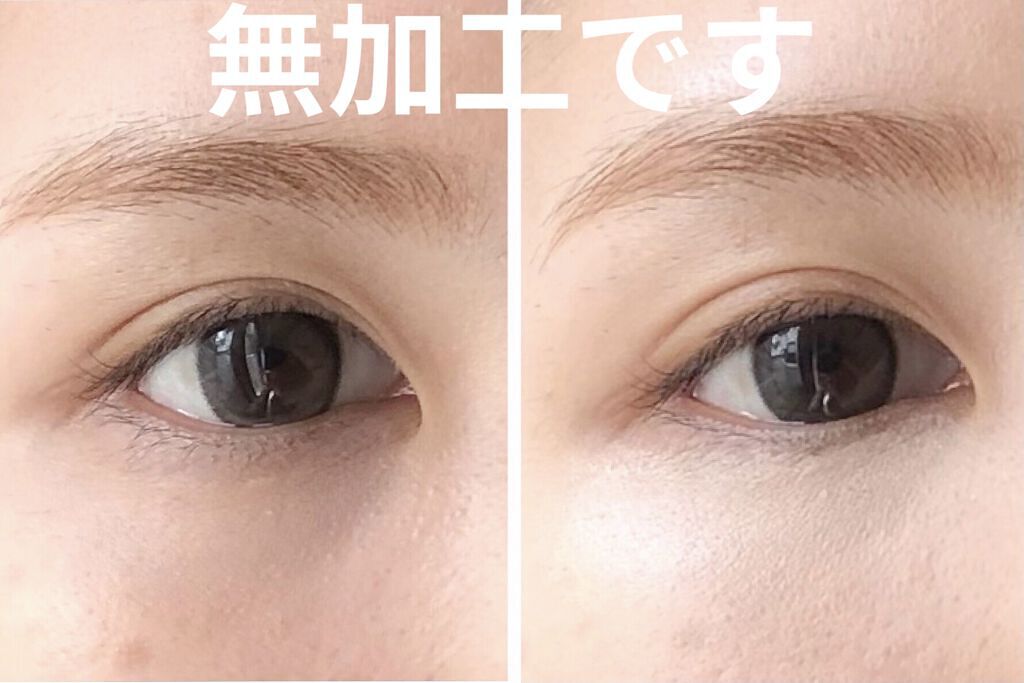 「目の下のくまで+10歳の老け顔に!【マッサージやコンシーラーによる原因別の改善方法】」の画像(#273349)