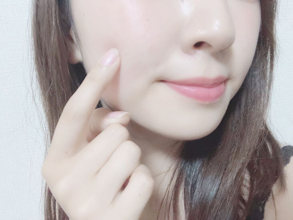 【シミ予防&シワ改善】ナイアシンアミド配合おすすめ人気スキンケア化粧品13選!効果・副作用まで解説の画像