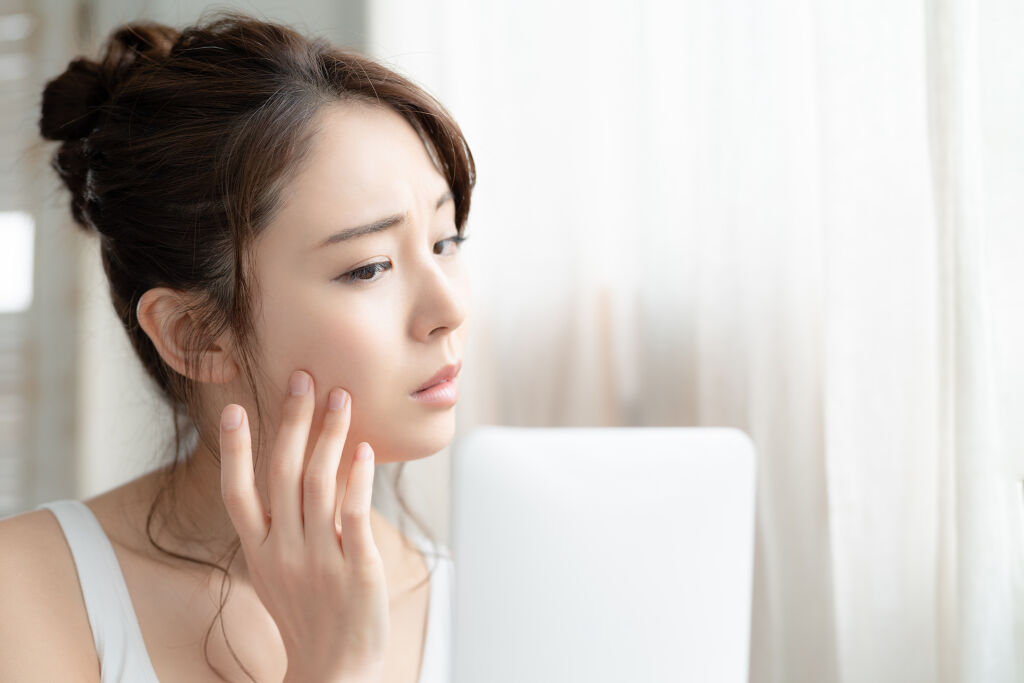 おすすめ化粧水12選|しつこい大人ニキビ!スキンケアを見直してトラブルが起こりにくい肌への画像