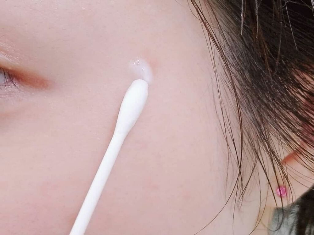 「シミ対策クリームを使って早めに予防スキンケア!【選び方とおすすめアイテム10選】」の画像(#303632)