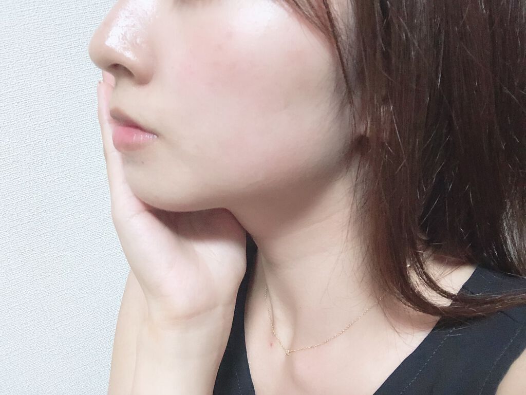 ワセリンを顔に塗るおすすめケア方法5選【効果的な使い方&ニキビや毛穴への注意点】の画像