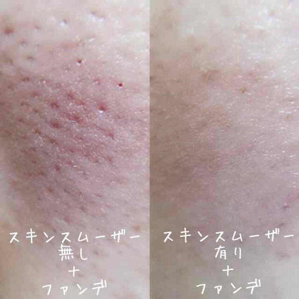 「カラフルな見た目に乙女心はノックアウト♡可愛すぎるマーブルコスメ特集」の画像(#66738)