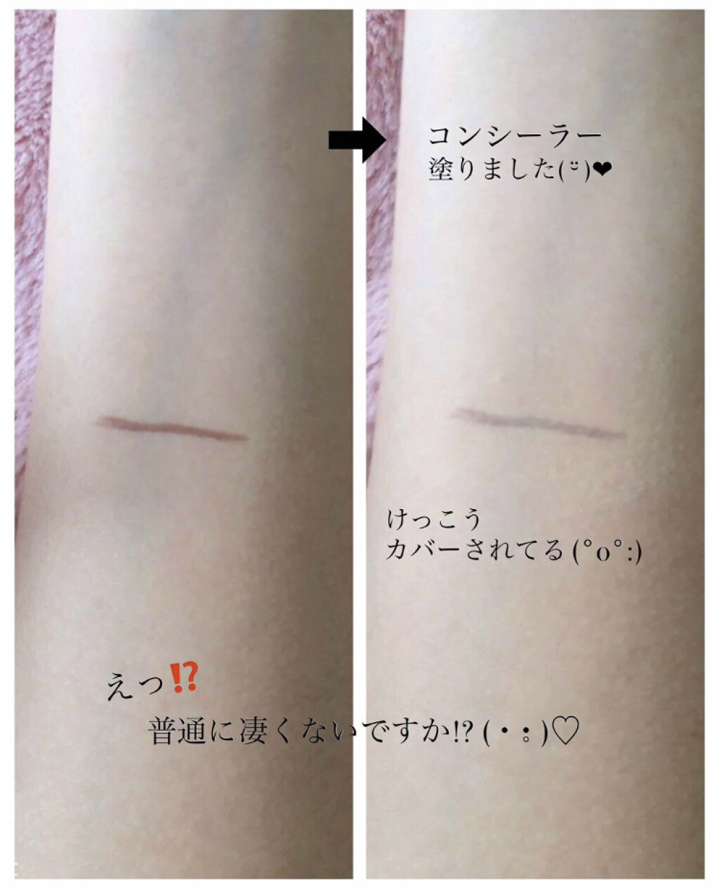 「気になる肌悩みも上手にカモフラージュ♡おすすめ優秀コンシーラーを集めました!」の画像(#75521)