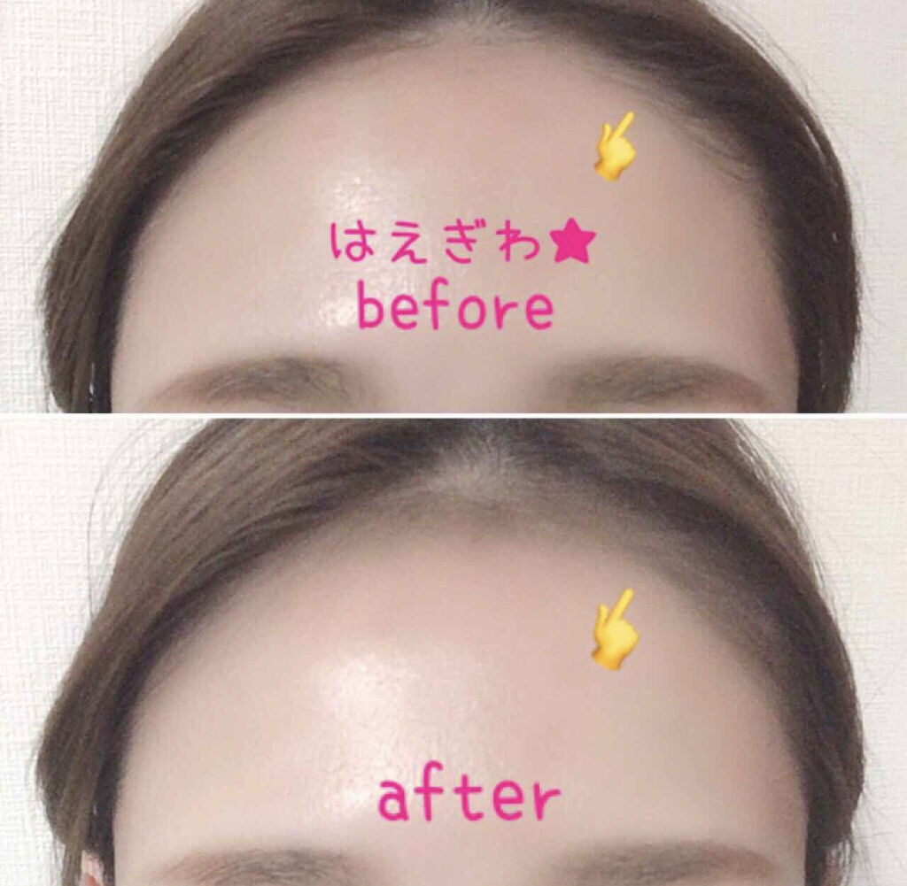 「キュッと引き締まった立体フェイスになりたいあなたへ。おすすめ小顔効果抜群コスメ5選♡」の画像(#80448)