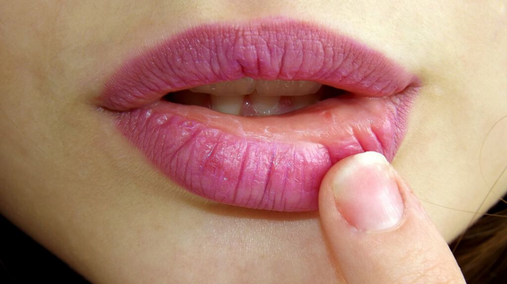 リップトリートメントでツヤ感あふれる唇に おすすめリップトリートメント10選 Lips