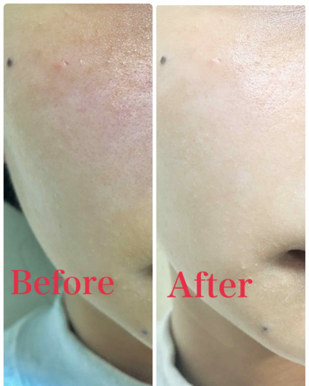 スキンミルク Ettusaisの口コミ 毛穴肌もするん 白たまご肌にパウダーinク By 武則天 脂性肌 Lips