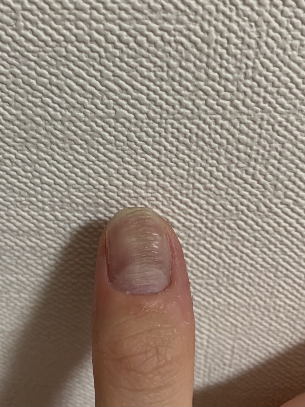 ディープセラム ローズの香り Dr Nailの口コミ ずっと悩んでる 親指の爪だけ横線ができてボ By Chanm I 乾燥肌 代前半 Lips