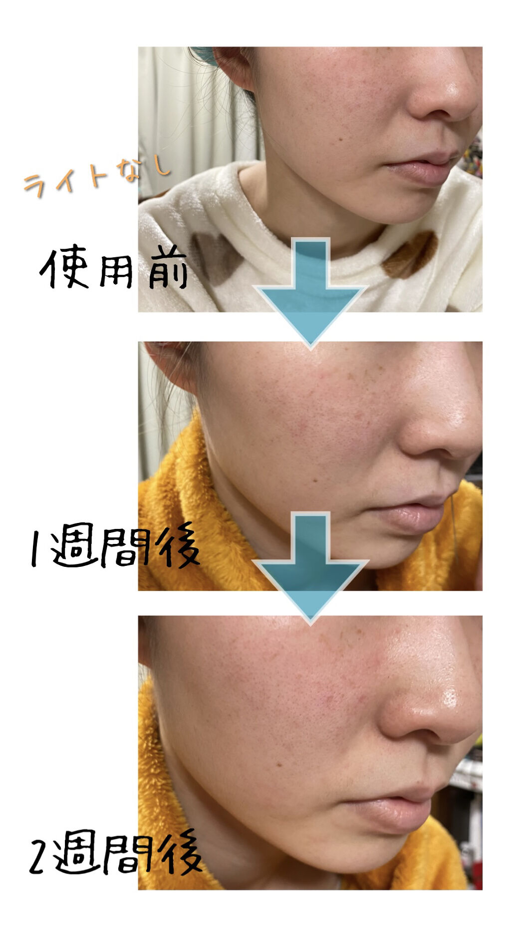 カワラヨモギエキス One Thingの辛口レビュー 赤み肌改善 実際に使ってみた結果 By ちー汰む 混合肌 Lips