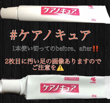 ケアノキュア 医薬品 小林製薬のリアルな口コミ レビュー Lips