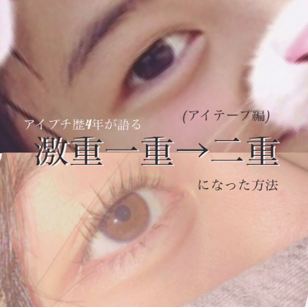 二重まぶた用シール Daisoの口コミ 超優秀 100均で買えるおすすめ二重まぶた用アイテム 二重になった方法 アイ By Yu 乾燥肌 Lips