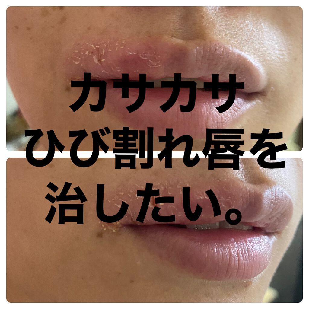 モアリップ N 医薬品 Shiseidoの口コミ カサカサの唇を治したい マスク荒れしている By Miki 乾燥肌 代後半 Lips