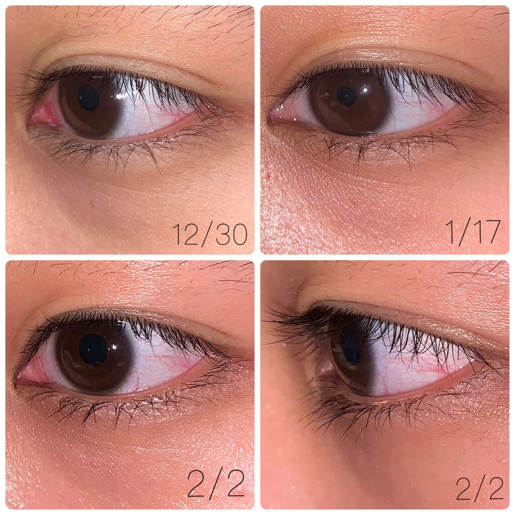 Emaked 水橋保寿堂製薬の口コミ まつ育エマーキットを約1ヶ月使ってみた結果 By 眠り子豚 混合肌 代前半 Lips