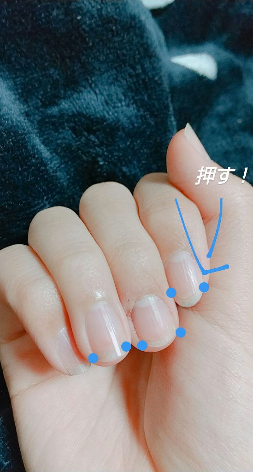 ニベアクリーム ニベアを使った口コミ 深爪だった私が 今回は深爪だっ By あず アトピー肌 Lips ニベアクリーム ニベアを使った口コミ 深爪だった私が 今回は深爪だっ By あず アトピー肌 Lips
