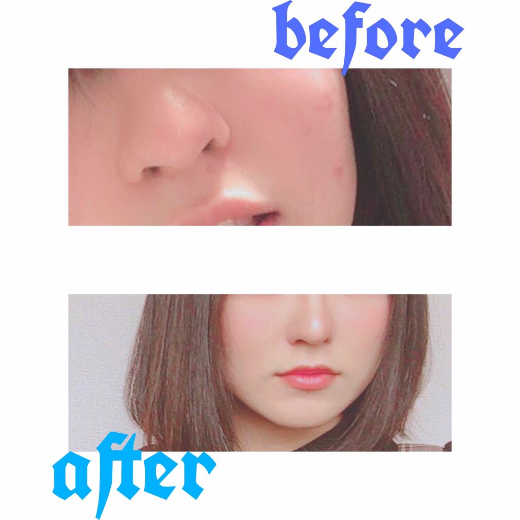 鼻スジ整形スティック Sukettoの口コミ どうも 今回は私の推しコスメを紹介します By ゆりもん 脂性肌 10代後半 Lips