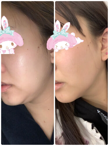頭皮が硬いと白髪やはげる原因に 1分でできる頭皮マッサージやおすすめグッズをご紹介 Lips 頭皮が硬いと白髪やはげる原因に 1分でできる頭皮マッサージやおすすめグッズをご紹介 Lips