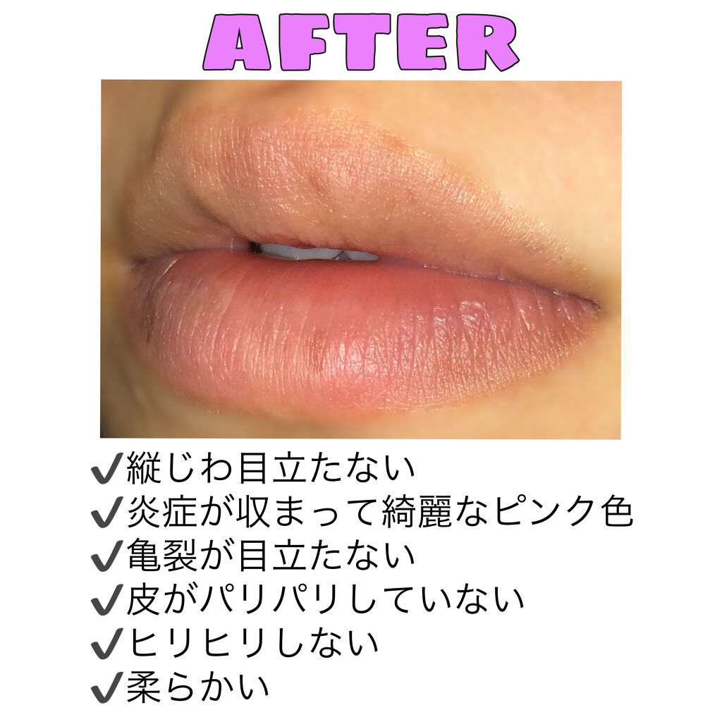 レブロン キス シュガー スクラブ Revlonの使い方を徹底解説 レブロンキスシュガースクラブ 球技大会を By ʚｒｉｒｉɞ 脂性肌 10代後半 Lips