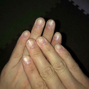 ディープセラム Dr Nailの口コミ 使用9日目ジェルネイルをオフした日から爪が By Coral Lips Kto Lips