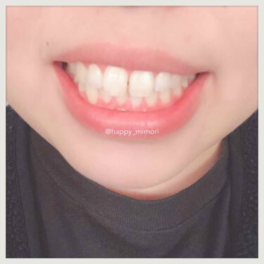 ティースホワイトパック スマイルコスメティックの口コミ この度スマイルコスメティックティースホワイ By みもりん 乾燥肌 Lips