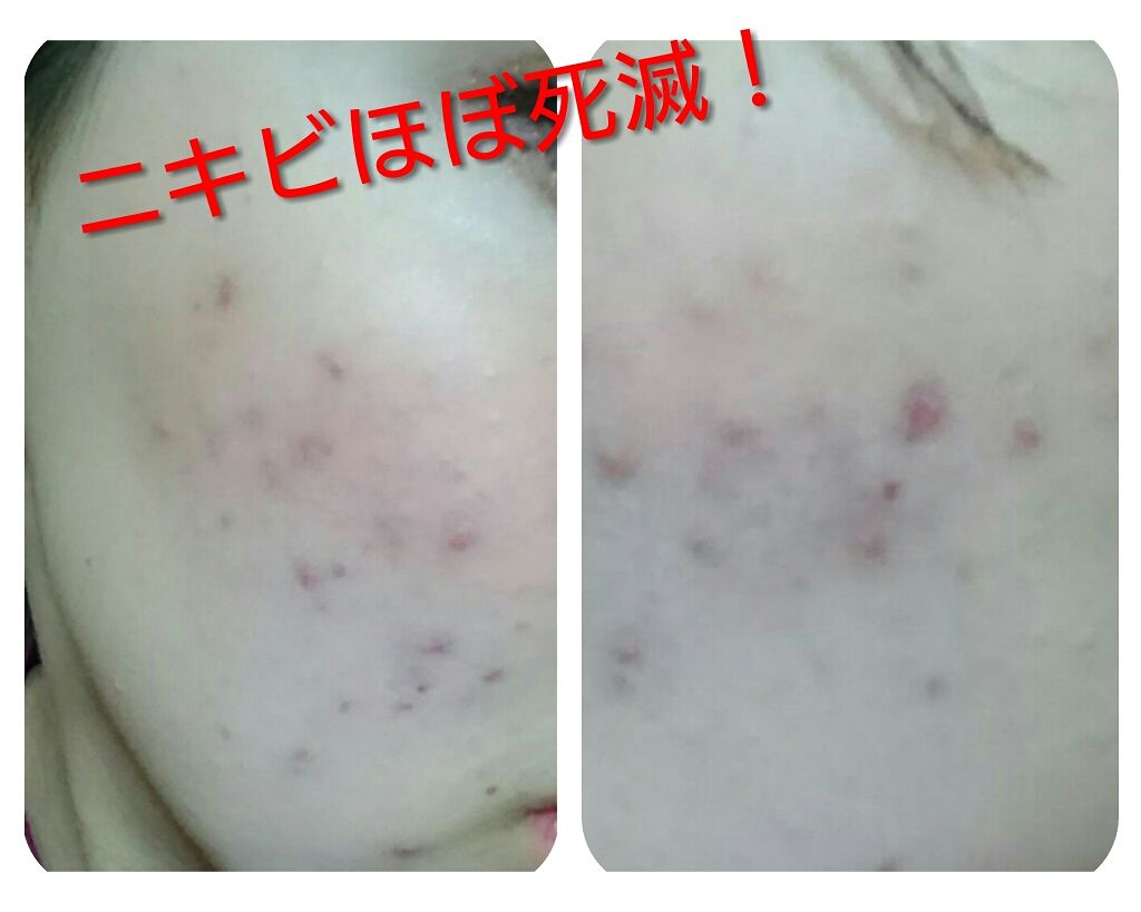 スキンケア方法 ビタミンc ハードカプセル Dhcの使い方 効果 こんにちは こんばんは By あめすぴ さん 乾燥肌 代前半 Lips