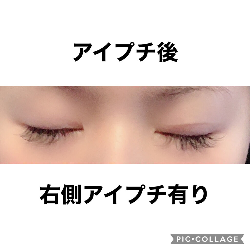 ワンダーアイリッドテープ Extra D Upの口コミ D Upワンダーアイリッドテープextra By Ma 敏感肌 代後半 Lips