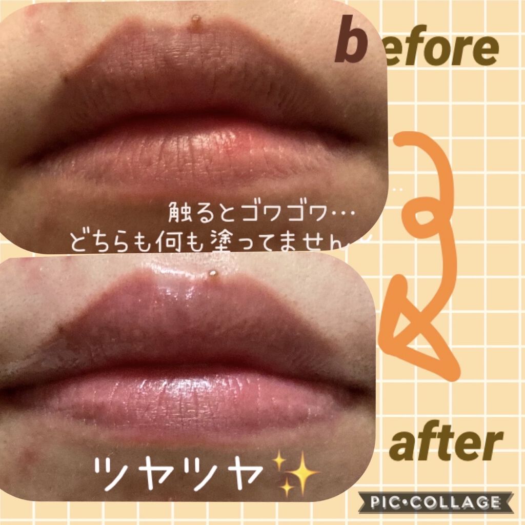 Bubibubi Lip Unpaの使い方を徹底解説 ブビブビ唇の角質ケア こんにちは By かめさん フォロバ 脂性肌 代後半 Lips