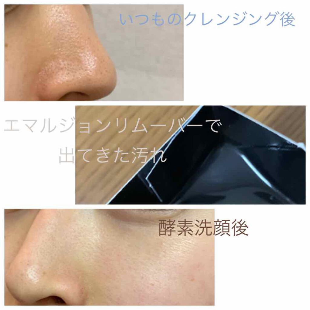 エマルジョンリムーバー 水橋保寿堂製薬を使った口コミ 毛穴が汚すぎて何やってもほんとにだめいいク By うさぎちゃん 敏感肌 Lips