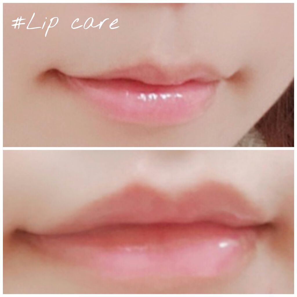 リップ美容液 Whomeeの口コミ いつもたくさんのいいねとフォローありがとう By しーぷ 敏感肌 代前半 Lips