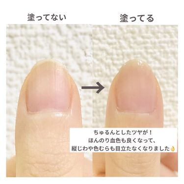 ディーアップファンデーション D Upの口コミ 自爪が可愛いく綺麗に見える ナチュラルなネ By サクラ 代前半 Lips