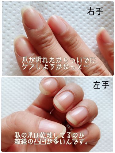 キューティクルリムーバー デュカートを使った口コミ ネイルケア方法 道具 デュカート By じじちゃん 混合肌 30代後半 Lips