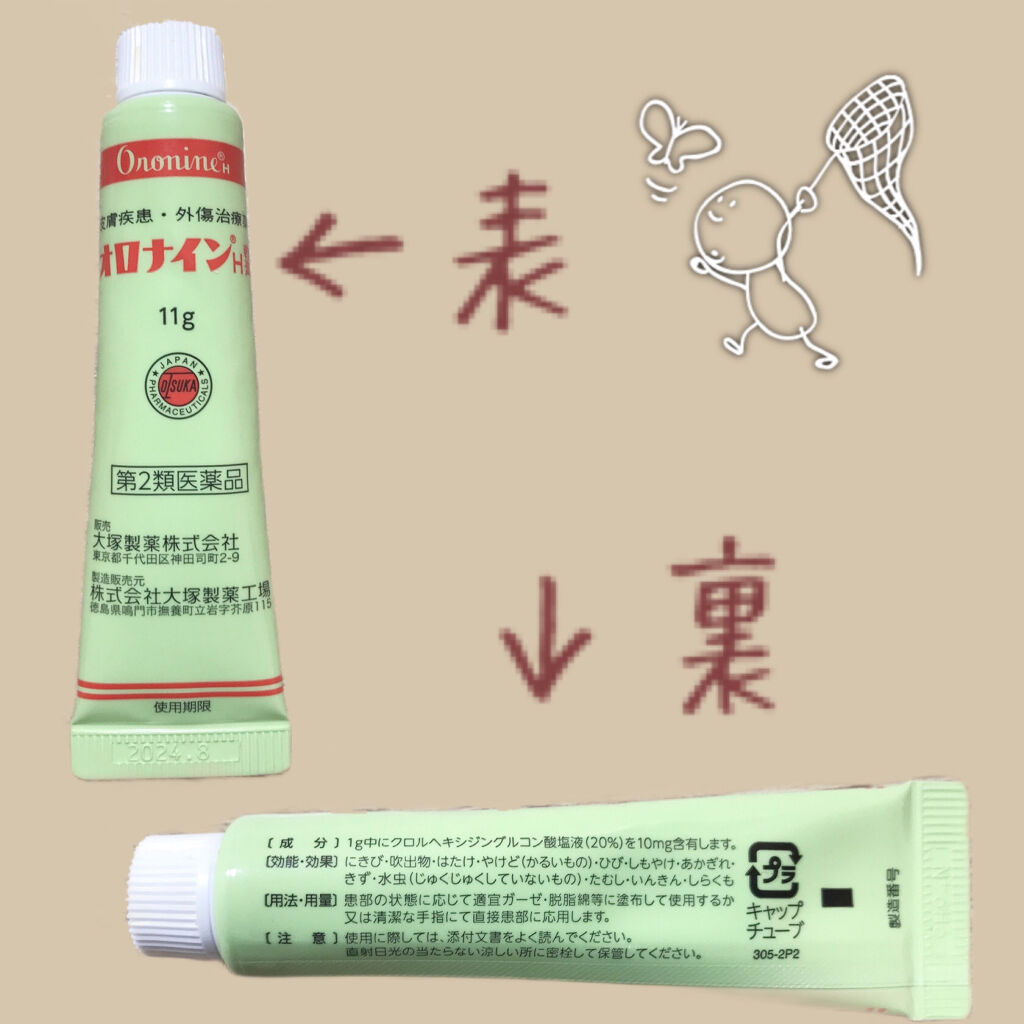 オロナインｈ軟膏 医薬品 オロナインの口コミ ささくれ抹殺 爪を強くキレイにする方法 By 𝙈𝙀𝙄 乾燥肌 10代前半 Lips