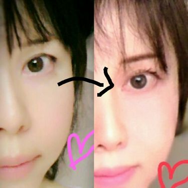 リバイタラッシュ アドバンス ジャパン エム アール アイを使った口コミ マツ育は焦らず 以前 ルミガンとケアプロス By 赤ちゃんほっぺ 敏感肌 Lips