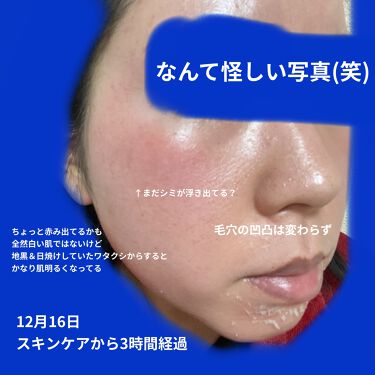 ミラミン／ZO Skin Healthのリアルな口コミ・レビュー | LIPS