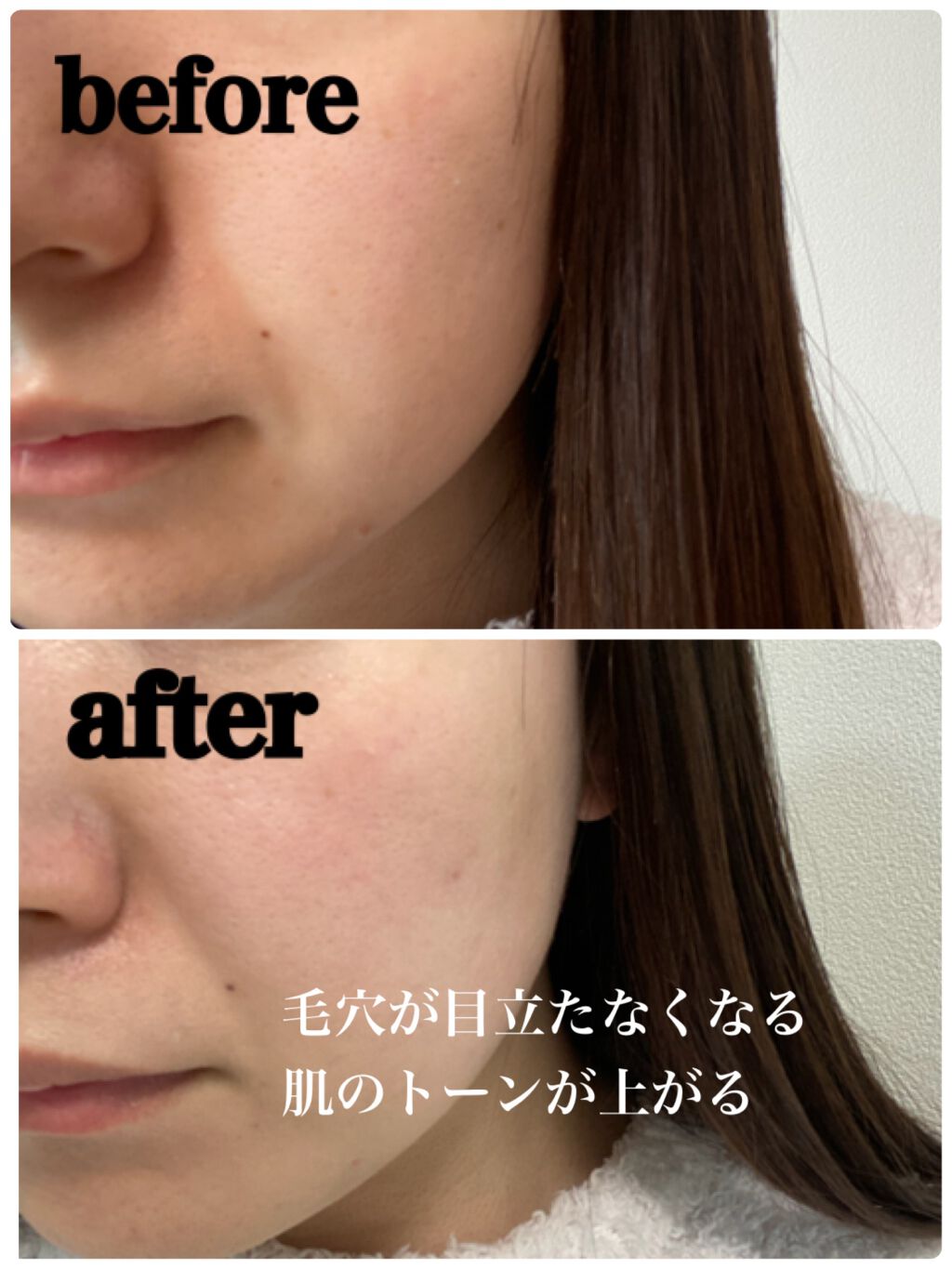 モイスチャーピーリングプロ Le Mentの口コミ 本日は毛穴汚れや古い角質が取れる とっても By Chii 混合肌 20代後半 Lips