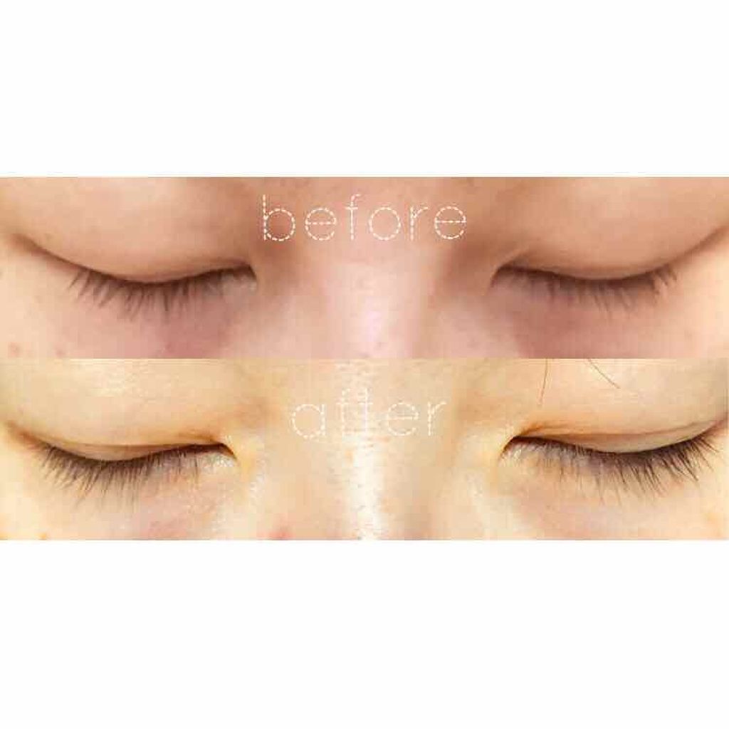 Emaked エマーキット 水橋保寿堂製薬の効果に関する口コミ 結論 効果アリつけまつげもまつエクもまつげ By やや 混合肌 30代前半 Lips