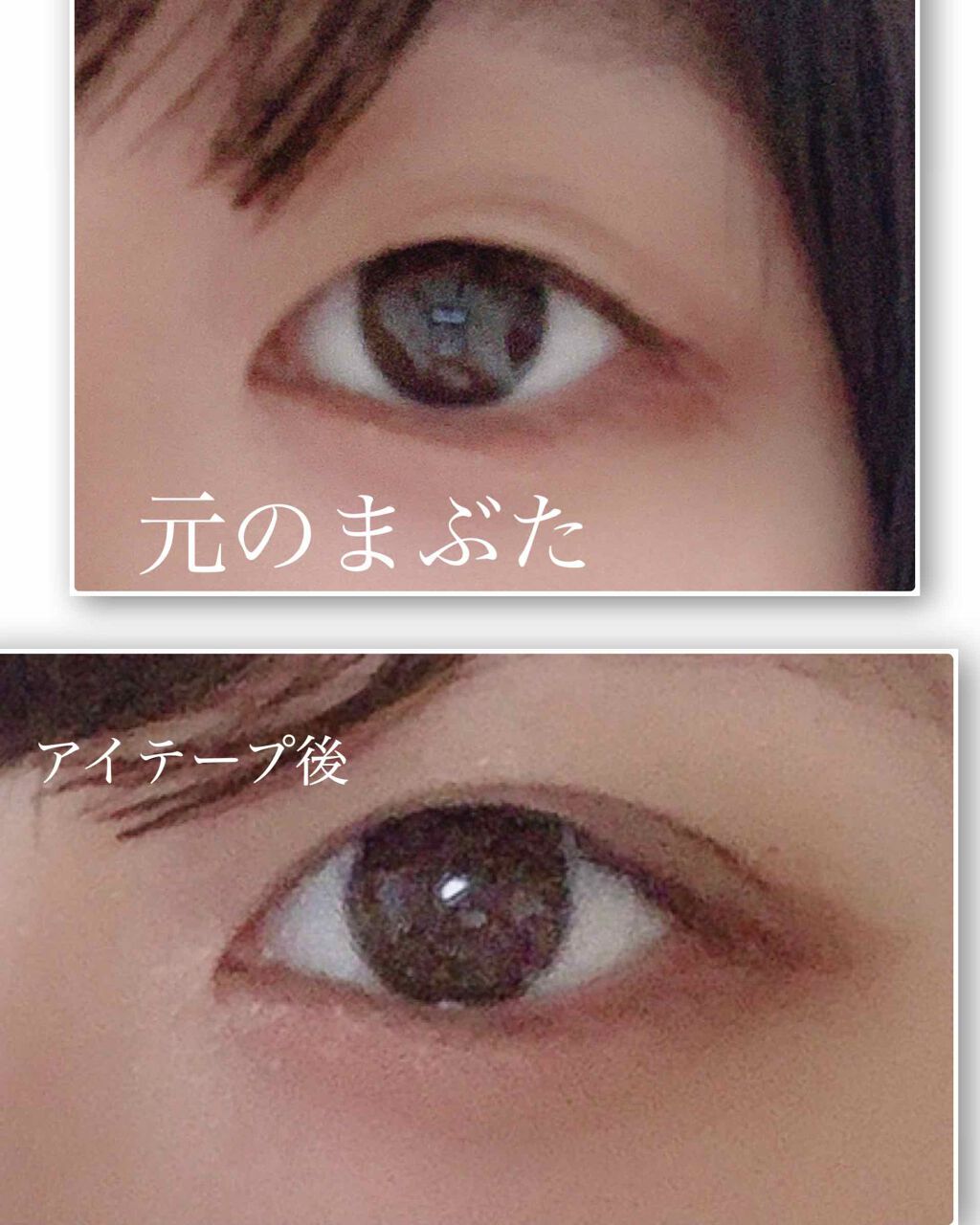 ナチュラルアイテープ Abの口コミ こんばんわ 初投稿 はじめまして ちゃまい By ちゃまい 乾燥肌 10代後半 Lips