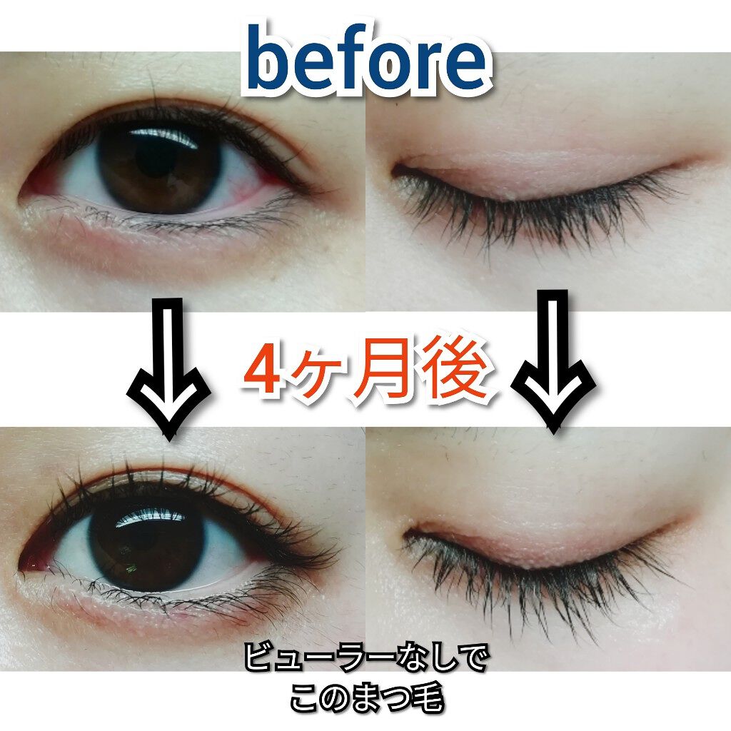 Emaked エマーキット 水橋保寿堂製薬の効果に関する口コミ Lipsでの初めての投稿に たくさんのいい By ことみるく 敏感肌 30代前半 Lips