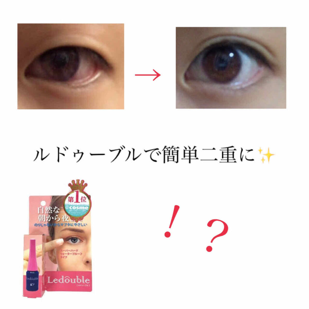 ルドゥーブル ルドゥーブルの口コミ ルドゥーブルで簡単二重 こんにちはヽ By ラムネ アトピー肌 Lips