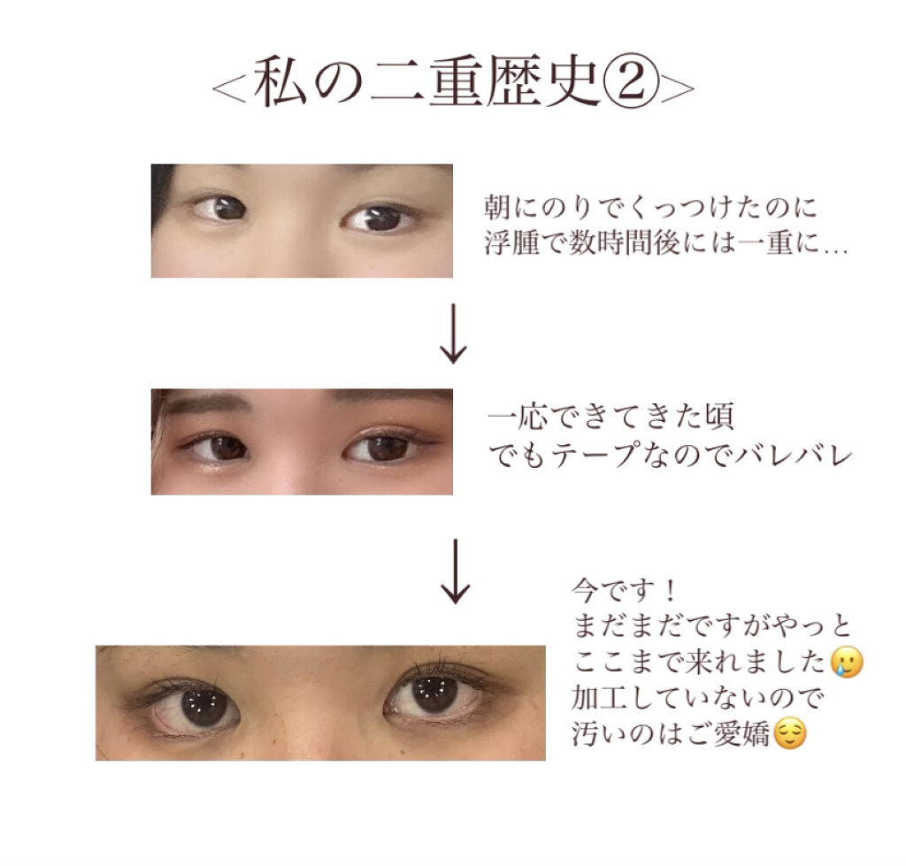 二重になる方法 のび る アイテープ 両面テープタイプ Daisoの使い方や二重メイク 一重に悩まされていた By Miya Lips