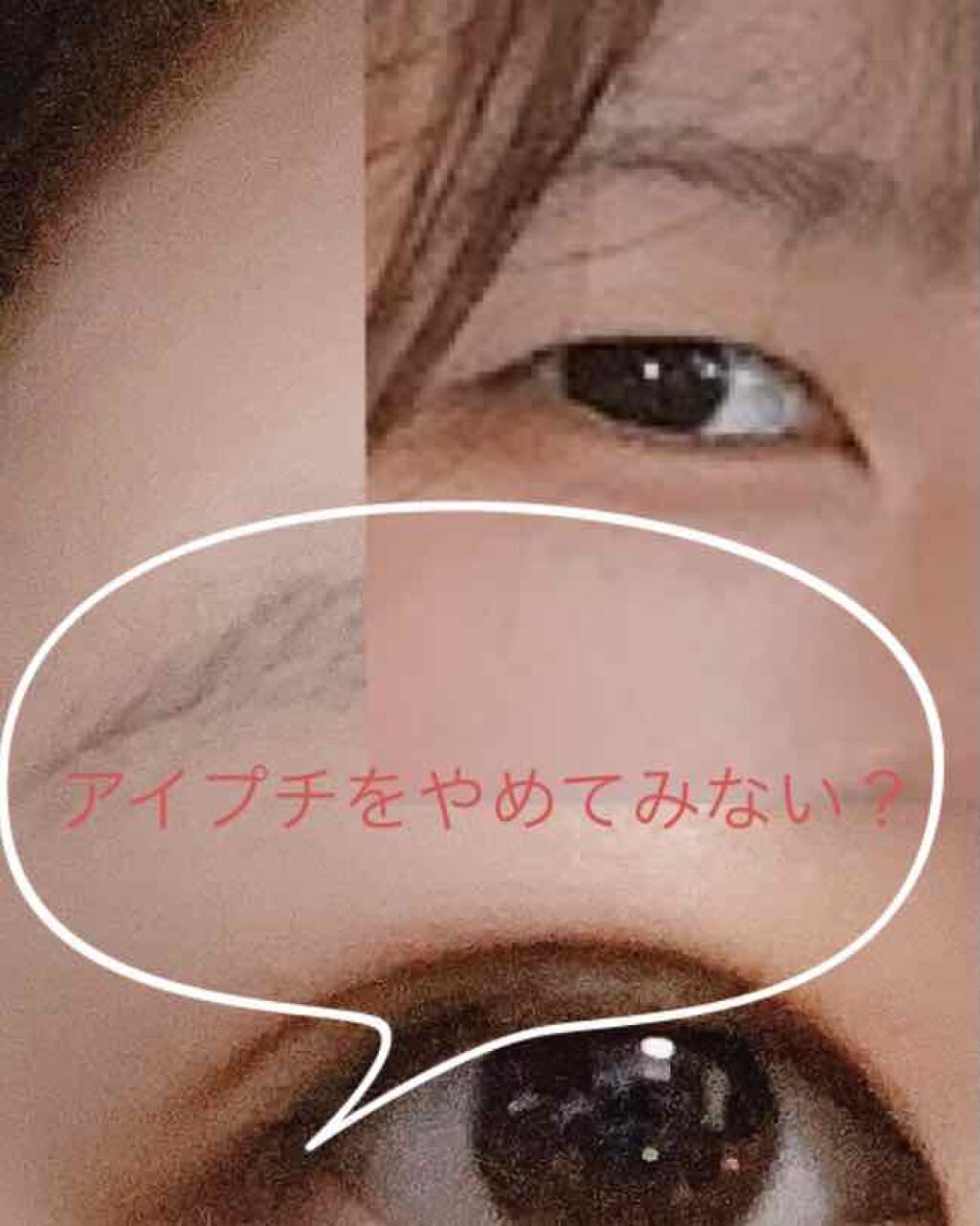 ルドゥーブル ルドゥーブルを使った口コミ アイプチやめたとたん二重になった 一年間ア By になさん Lips