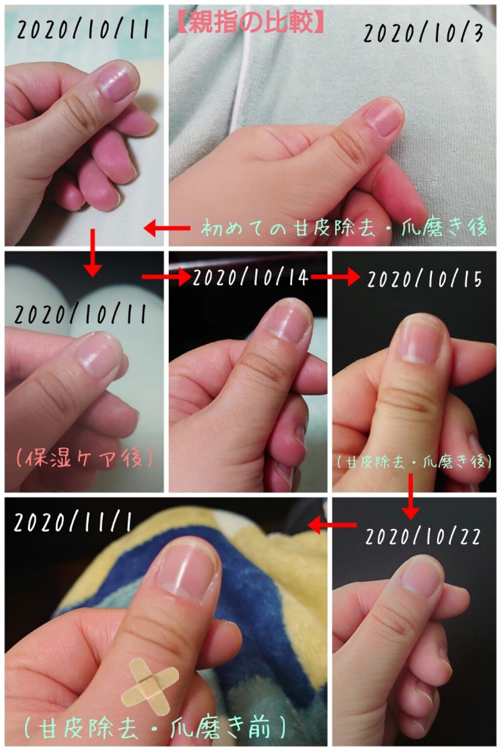 ディープセラム Dr Nailを使った口コミ 1ヶ月経過したので経過報告をまとめます By ヒバリヤ 混合肌 代後半 Lips