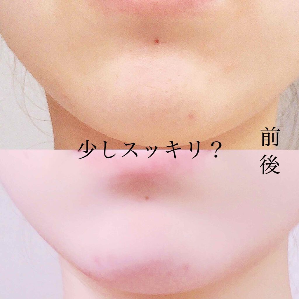 ミノン アミノモイスト モイストチャージ ミルク ミノンの効果に関する口コミ パリコレ流の小顔ストレッチ効果あり 明るさ By Yuna 毎日投稿 乾燥肌 代前半 Lips