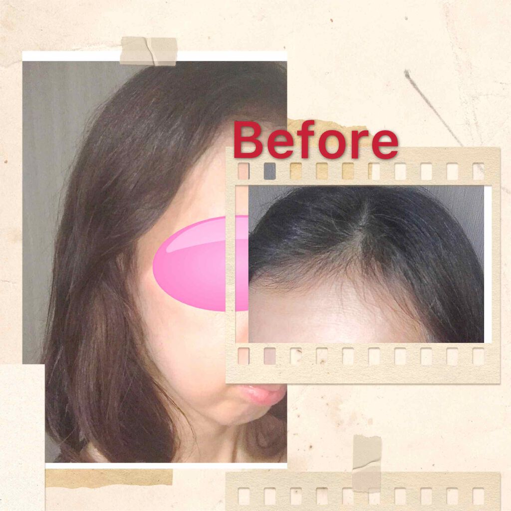 泡カラー 白髪用 ブローネの辛口レビュー セルフ白髪染めビフォーアフターです 泡タイ By ふらんきんせんす ふらん イエベ秋 乾燥肌 40代後半 Lips