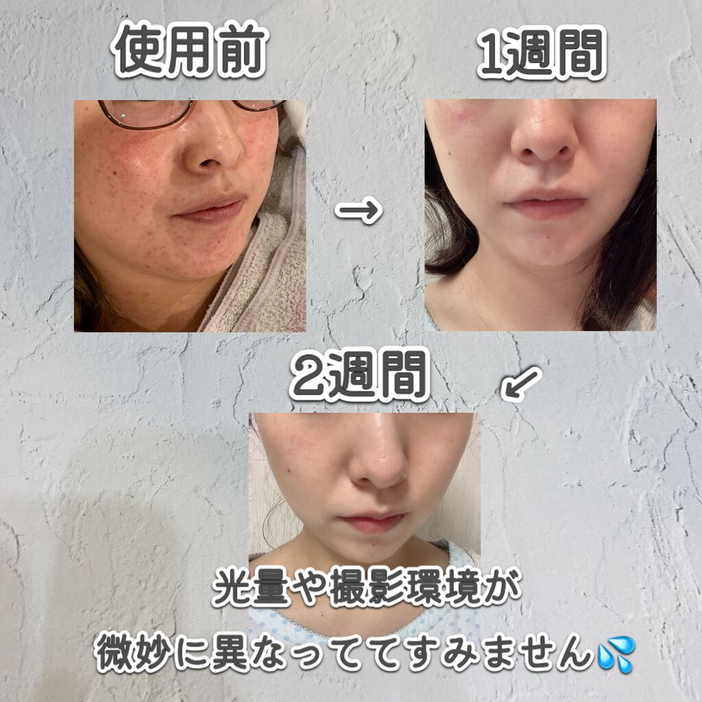 フェイシャル トリートメント エッセンス Sk Iiの効果に関する口コミ 乾燥肌におすすめの化粧水 Sk Ii14日間でど By Miso路ママ Lips