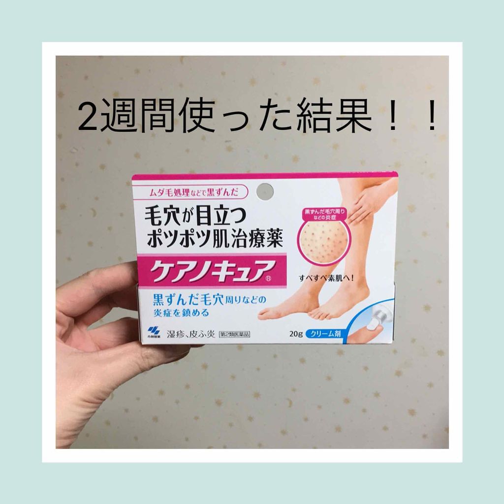 ケアノキュア(医薬品)｜小林製薬の口コミ「このケアノキュアを使い続けて2週間がたった..」 by ズボラ母(乾燥肌) | LIPS