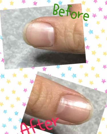 クイックケアコート Ettusaisの口コミ 素爪でいるより 爪にいいリムーバー不要 By Colorful Gloss Pk2 混合肌 Lips