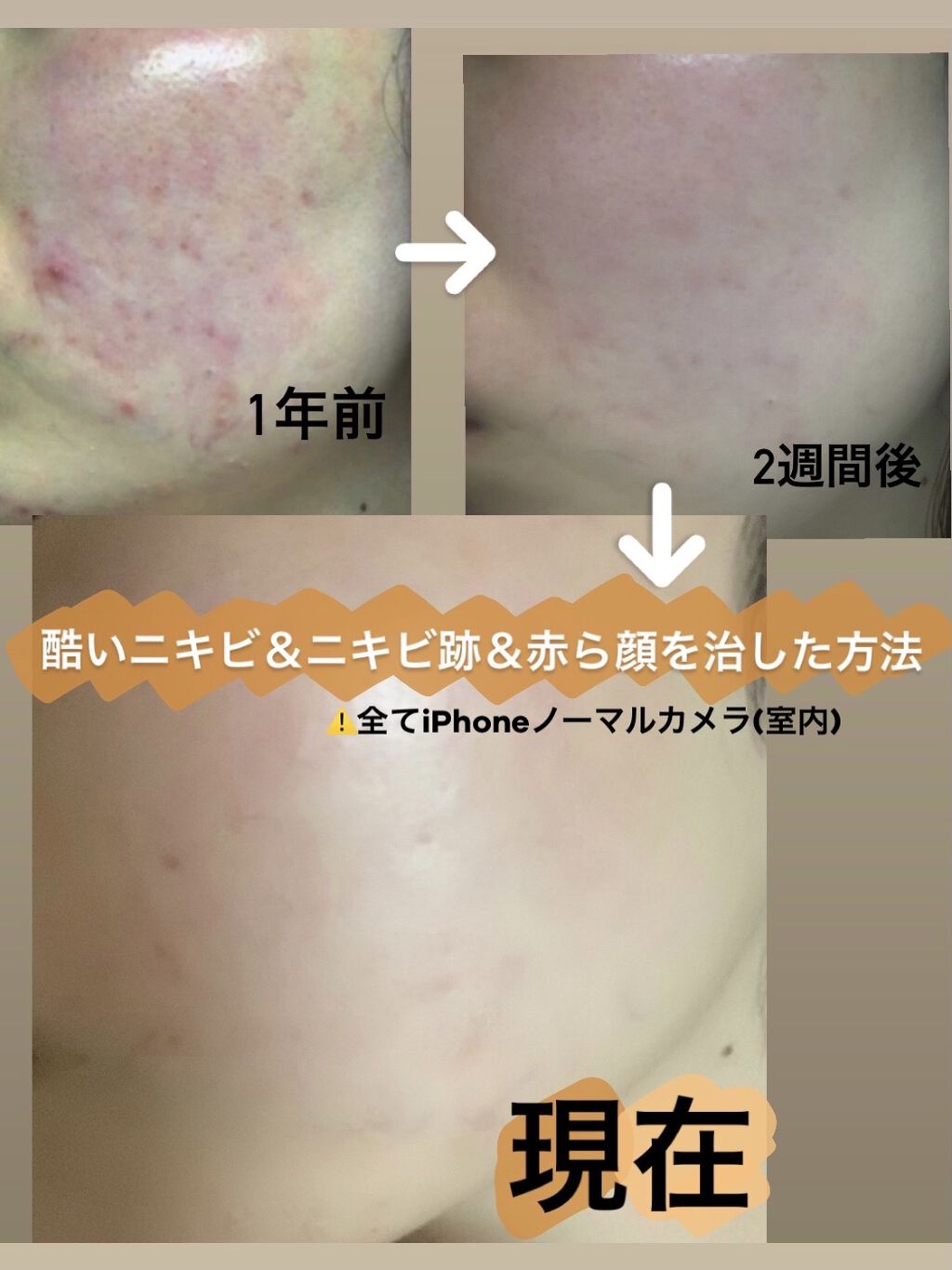 Yoan 話題沸騰中のコスメ 真似したいメイク方法の口コミが84件 デパコスからプチプラまで Lips