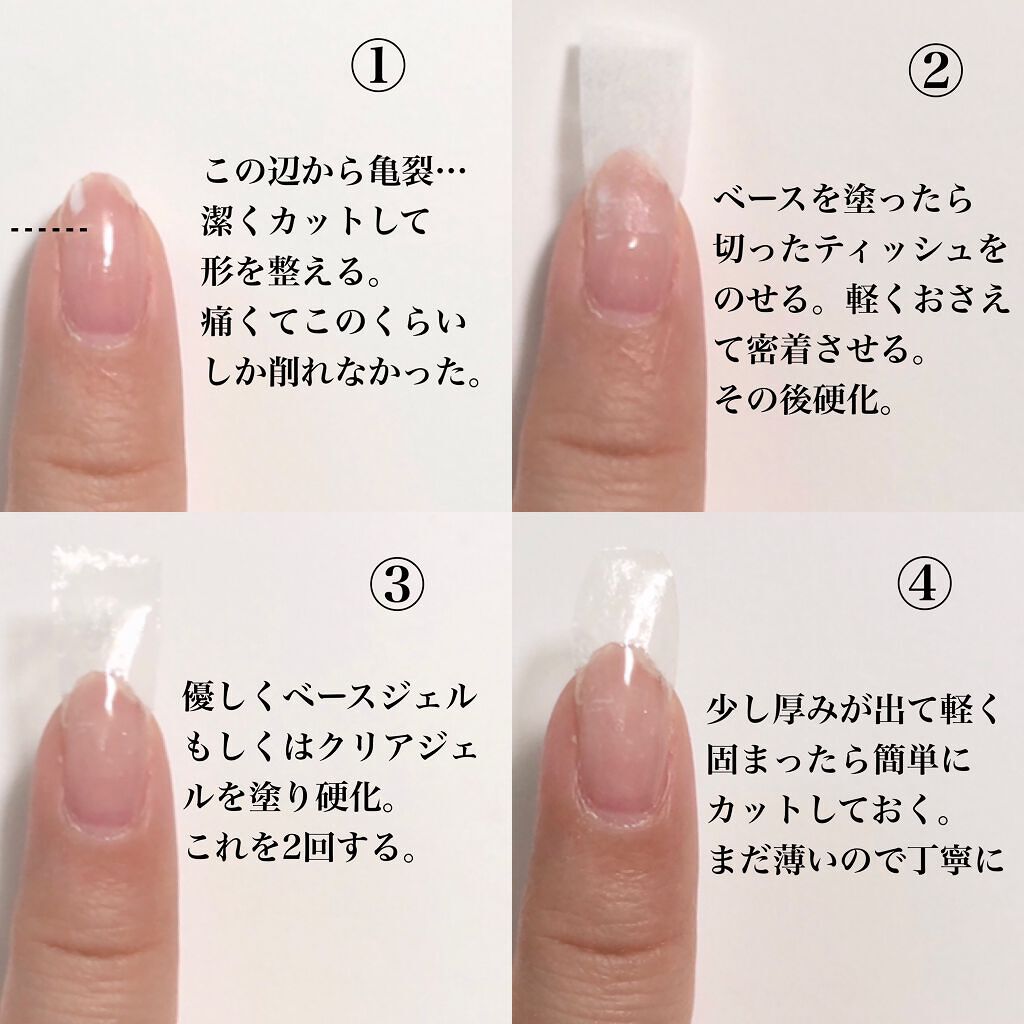 Shジェルネイル ライト対応 セリアを使った口コミ ティッシュで簡単長さ出し 爪が折れて無く By チャンユカ 敏感肌 Lips Shジェルネイル ライト対応 セリアを使った口コミ ティッシュで簡単長さ出し 爪が折れて無く By チャンユカ 敏感肌 Lips