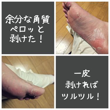 ソフトミネラルフットピーリングパック Mj Careの口コミ ブロガーの渡辺リリオです 初投稿につき不手 By 渡辺リリオ ブロガー 乾燥肌 Lips